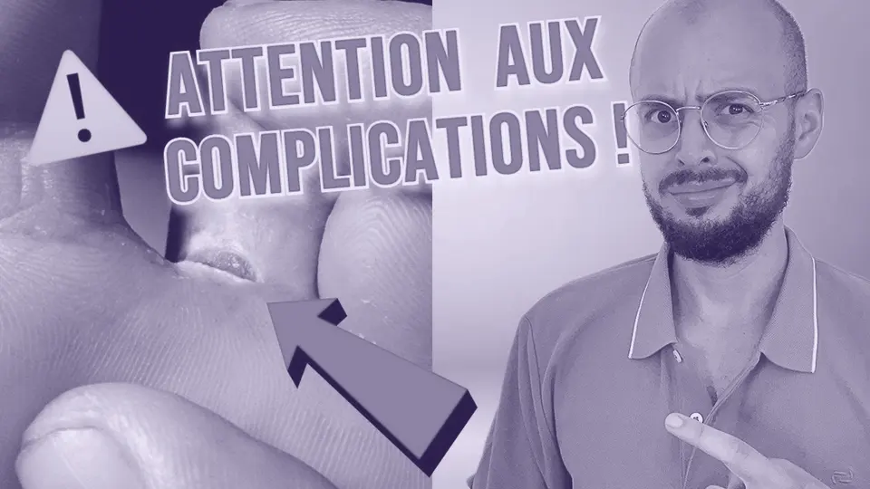 Vignette de la vidéo : Mycose entre les orteils : pourquoi s'en méfier ?